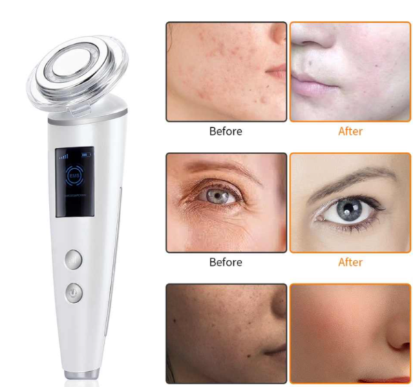Бьюти устройство для ухода за кожей лица Beauty Instrument DS-8811 (чистка, стимуляция, подтяжка, массаж кожи лица и кожи вокруг глаз)